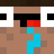XR0CKETT